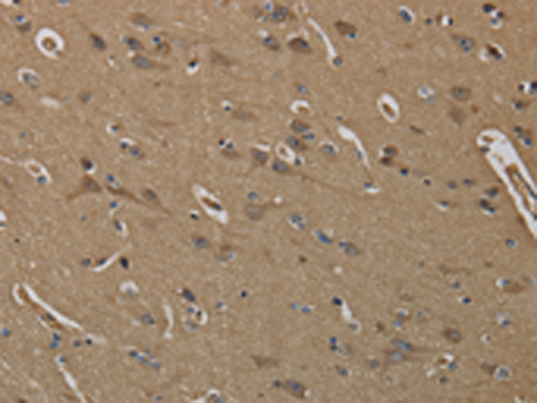 Anti-Kallikrein 6 Rabbit Polyclonal Antibody