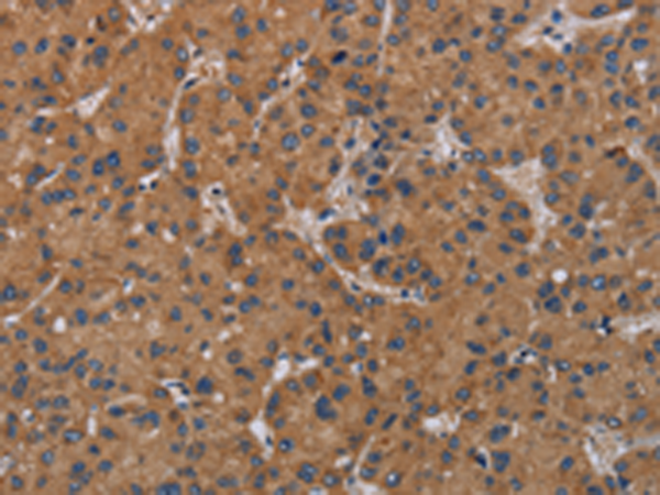 Anti-Kallikrein 13 Rabbit Polyclonal Antibody