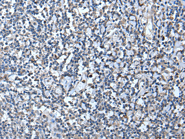 Anti-Lactate Dehydrogenase C Rabbit Polyclonal Antibody