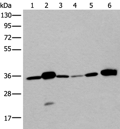 Anti-Lactate Dehydrogenase C Rabbit Polyclonal Antibody
