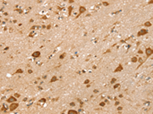 Anti-LMO4 Rabbit Polyclonal Antibody