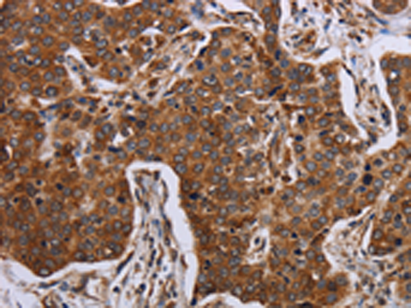 Anti-ACP6 Rabbit Polyclonal Antibody