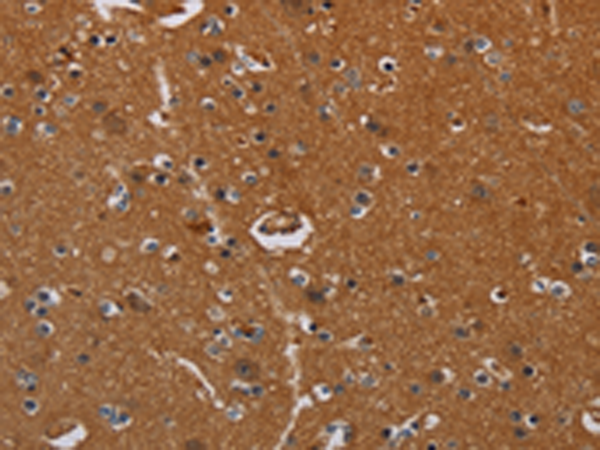 Anti-LRRC57 Rabbit Polyclonal Antibody