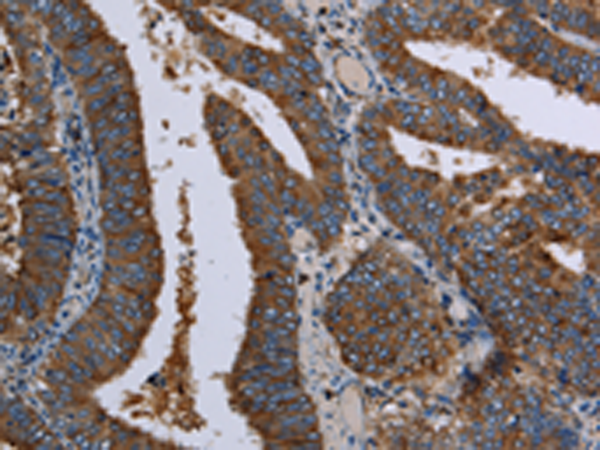 Anti-LZTFL1 Rabbit Polyclonal Antibody