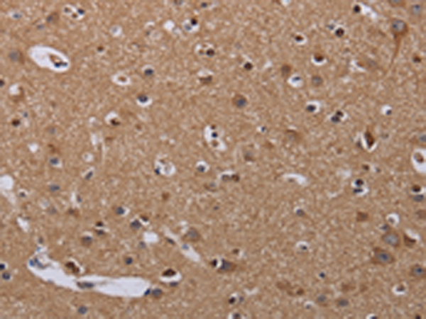 Anti-MCT 1 Rabbit Polyclonal Antibody