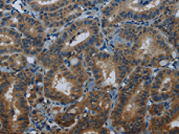 Anti-MEI1 Rabbit Polyclonal Antibody