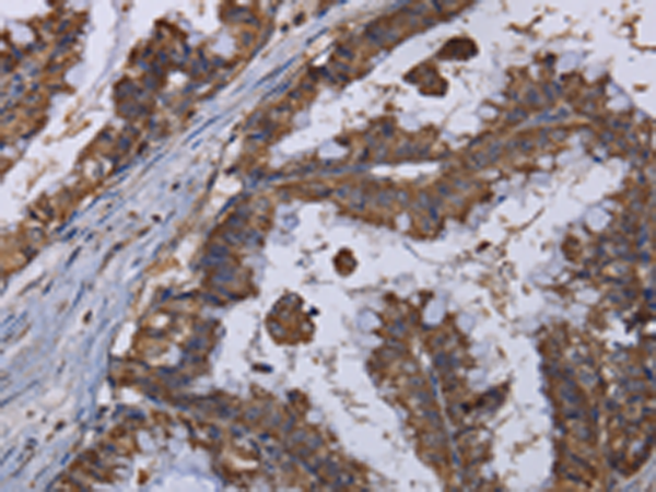 Anti-MT3 Rabbit Polyclonal Antibody