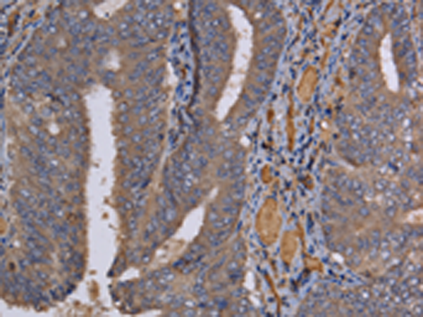 Anti-REG3G Rabbit Polyclonal Antibody