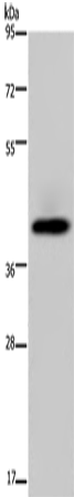 Anti-SERPINB3 Rabbit Polyclonal Antibody