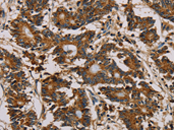Anti-Mitochondrial Ribosomal Protein L11 Rabbit Polyclonal Antibody