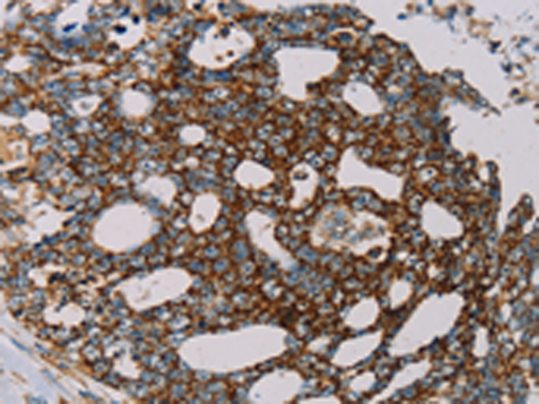 Anti-MRPL12 Rabbit Polyclonal Antibody