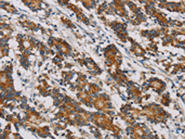 Anti-MRPL28 Rabbit Polyclonal Antibody
