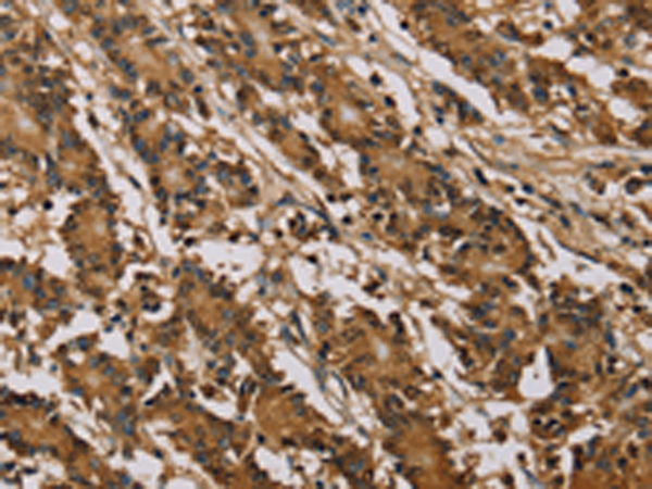 Anti-PSMC2 Rabbit Polyclonal Antibody