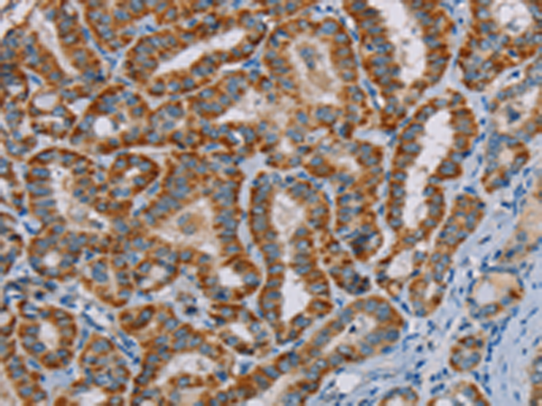 Anti-MTCH2 Rabbit Polyclonal Antibody