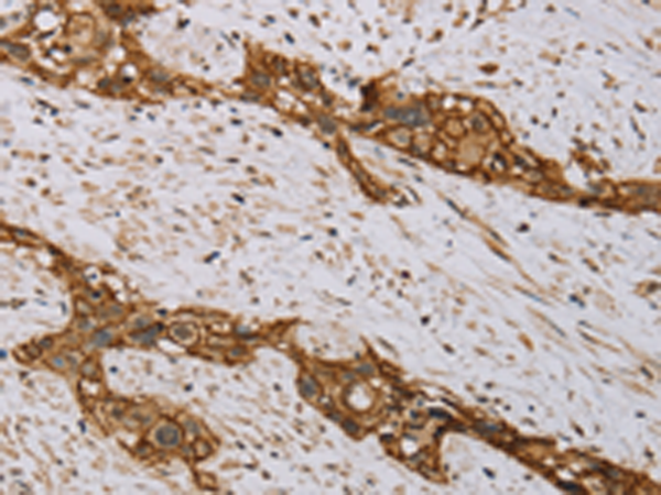 Anti-MVK Rabbit Polyclonal Antibody