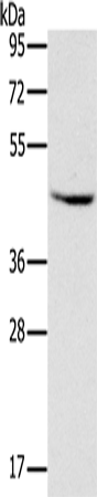 Anti-MVK Rabbit Polyclonal Antibody