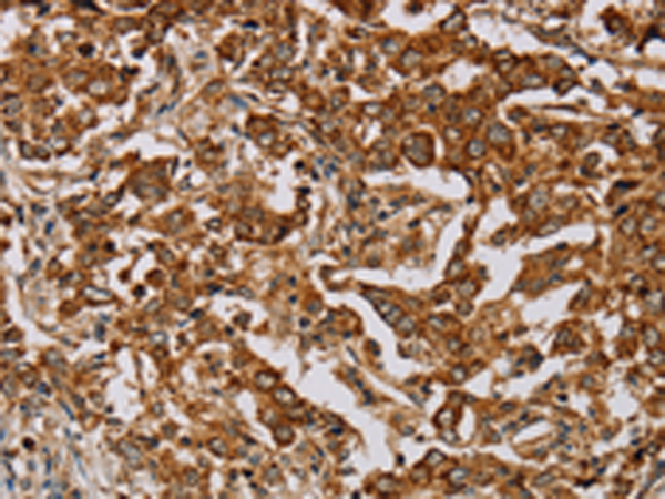 Anti-Myoglobin Rabbit Polyclonal Antibody
