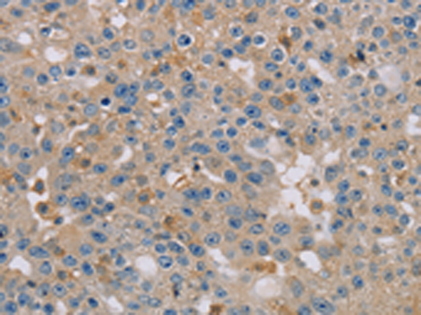 Anti-CLIC1 Rabbit Polyclonal Antibody