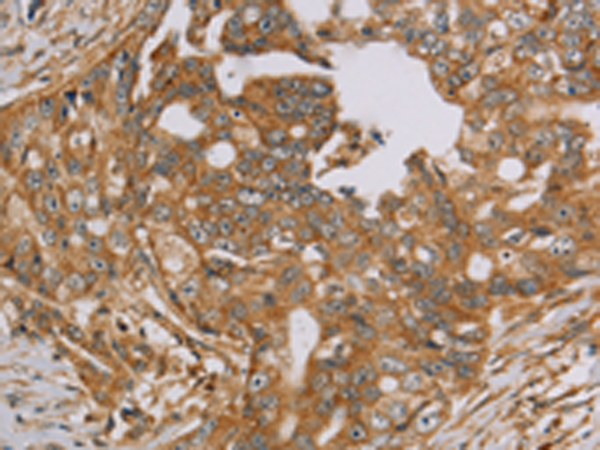 Anti-NDUFA10 Rabbit Polyclonal Antibody