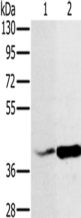Anti-NDUFA10 Rabbit Polyclonal Antibody