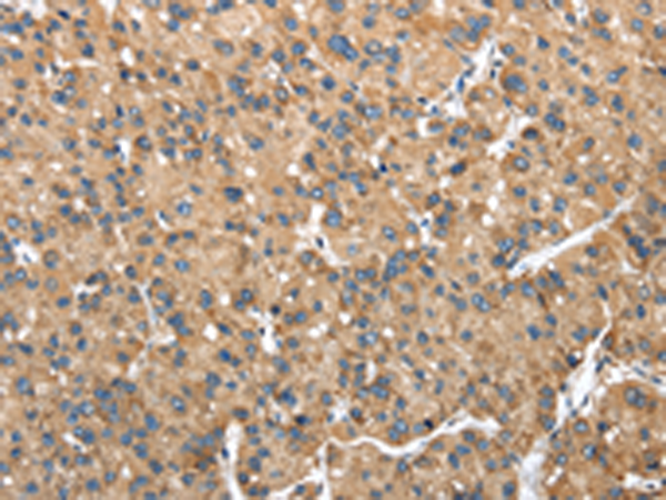 Anti-NDUFA5 Rabbit Polyclonal Antibody