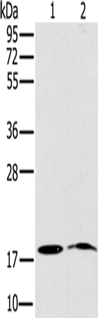 Anti-NDUFA3 Rabbit Polyclonal Antibody