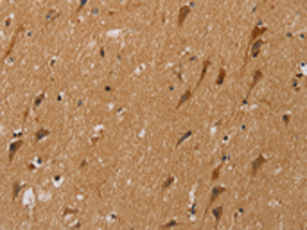 Anti-NDUFS5 Rabbit Polyclonal Antibody