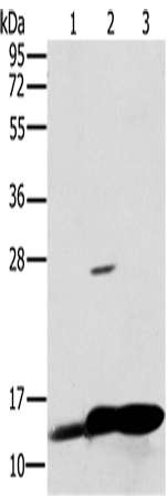 Anti-NDUFS5 Rabbit Polyclonal Antibody