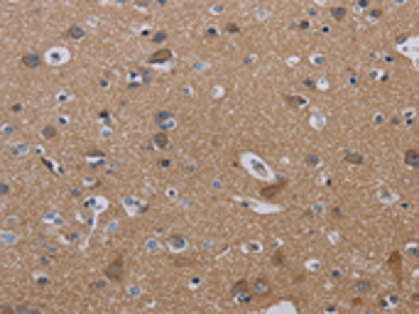 Anti-Nectin 3 Rabbit Polyclonal Antibody