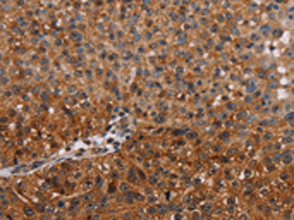 Anti-NMT2 Rabbit Polyclonal Antibody