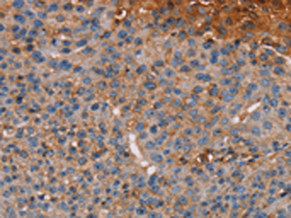 Anti-NOC2L Rabbit Polyclonal Antibody