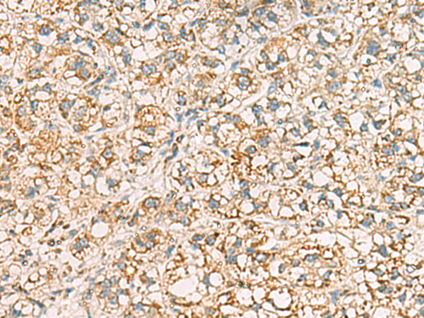 Anti-NOX5 Rabbit Polyclonal Antibody