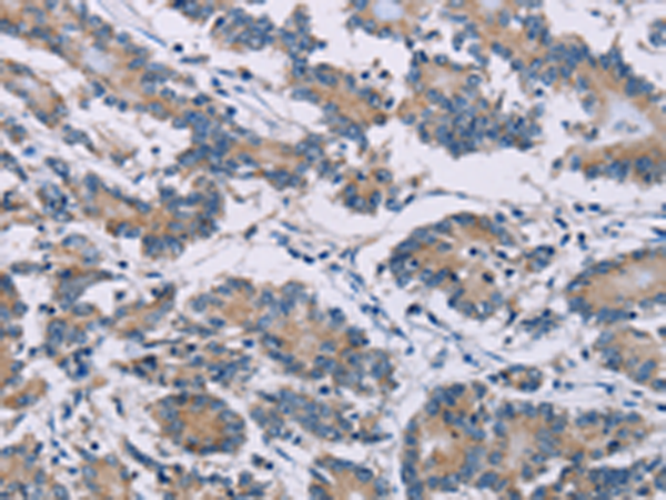 Anti-Cenexin1 Rabbit Polyclonal Antibody