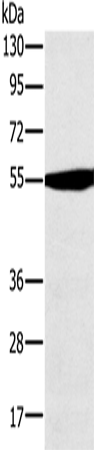 Anti-OXCT1 Rabbit Polyclonal Antibody