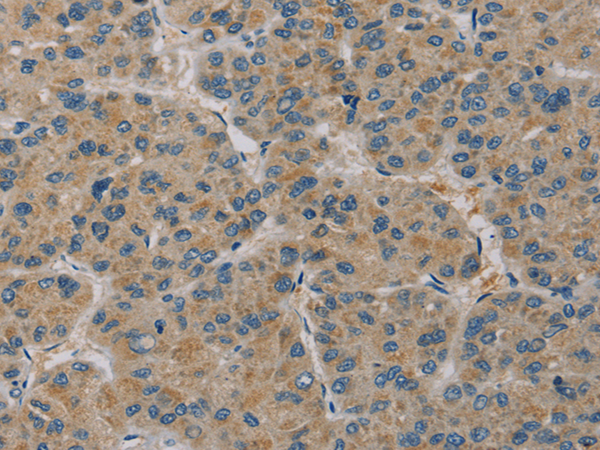 Anti-PAGE2 Rabbit Polyclonal Antibody