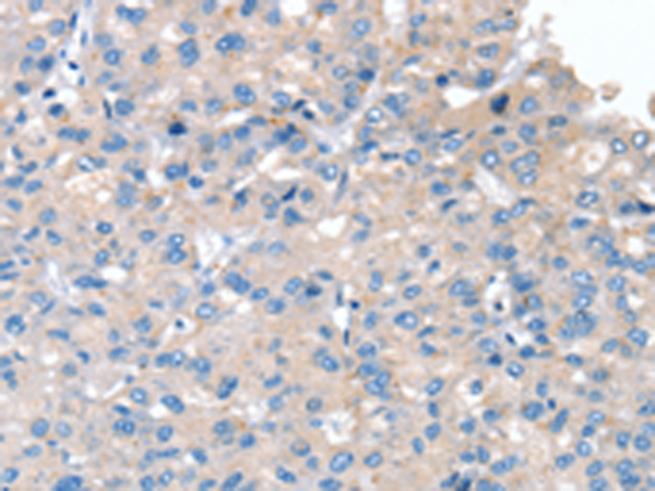 Anti-SERPINB2 Rabbit Polyclonal Antibody