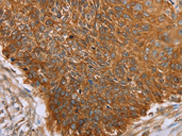 Anti-PAICS Rabbit Polyclonal Antibody
