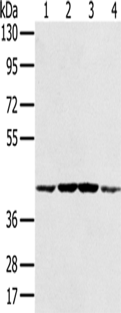 Anti-PAICS Rabbit Polyclonal Antibody