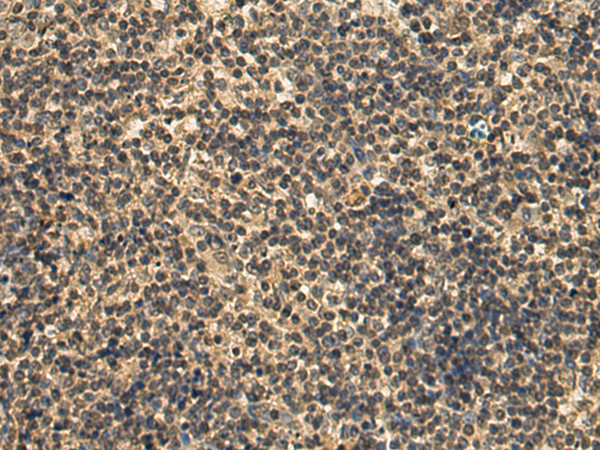Anti-PCMT1 Rabbit Polyclonal Antibody