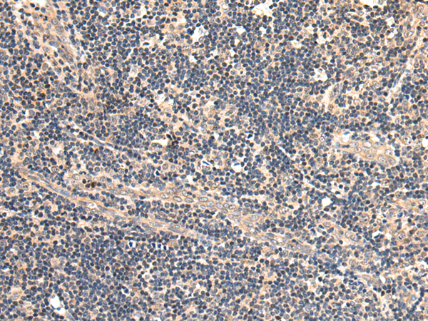 Anti-PDGFRL Rabbit Polyclonal Antibody