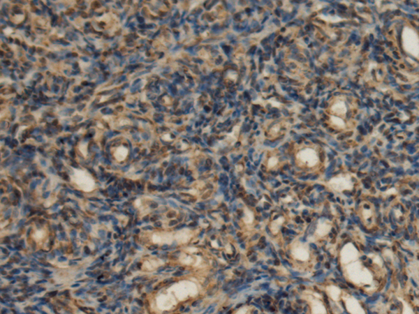 Anti-Pyruvate Dehydrogenase E1 beta Rabbit Polyclonal Antibody