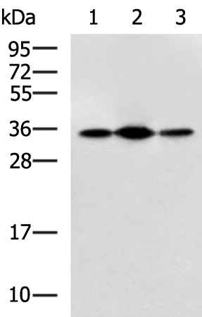Anti-Pyruvate Dehydrogenase E1 beta Rabbit Polyclonal Antibody