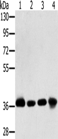 Anti-PDLIM1 Rabbit Polyclonal Antibody