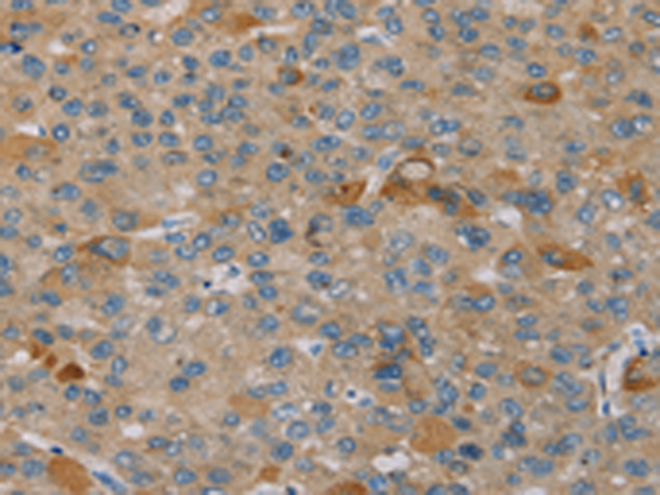 Anti-PEF1 Rabbit Polyclonal Antibody