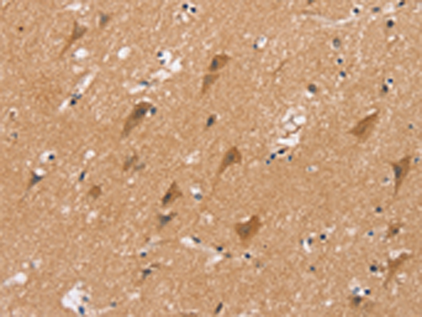 Anti-Prostate Secretory Protein Rabbit Polyclonal Antibody