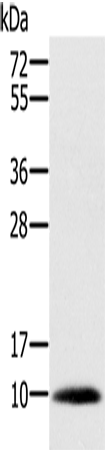 Anti-Prostate Secretory Protein Rabbit Polyclonal Antibody