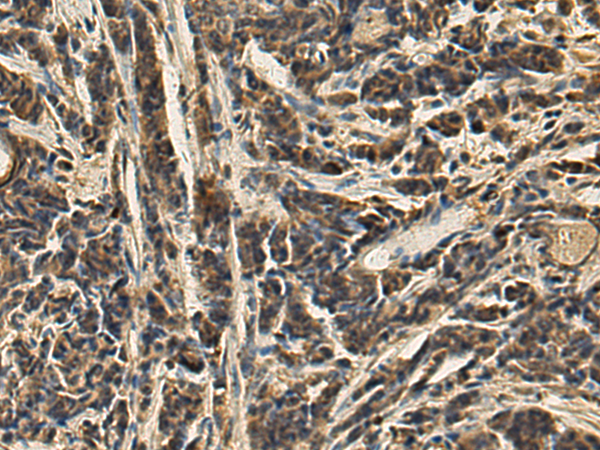 Anti-PGAM2 Rabbit Polyclonal Antibody
