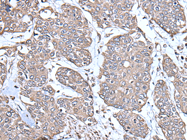 Anti-PGRMC1 Rabbit Polyclonal Antibody