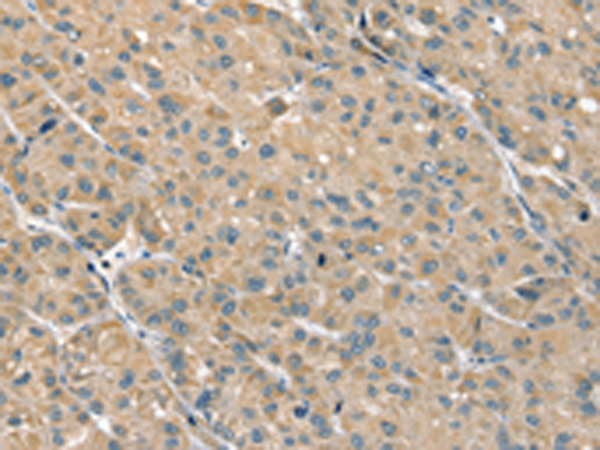 Anti-SCOP Rabbit Polyclonal Antibody