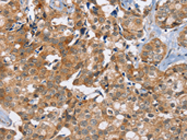 Anti-PHYH Rabbit Polyclonal Antibody